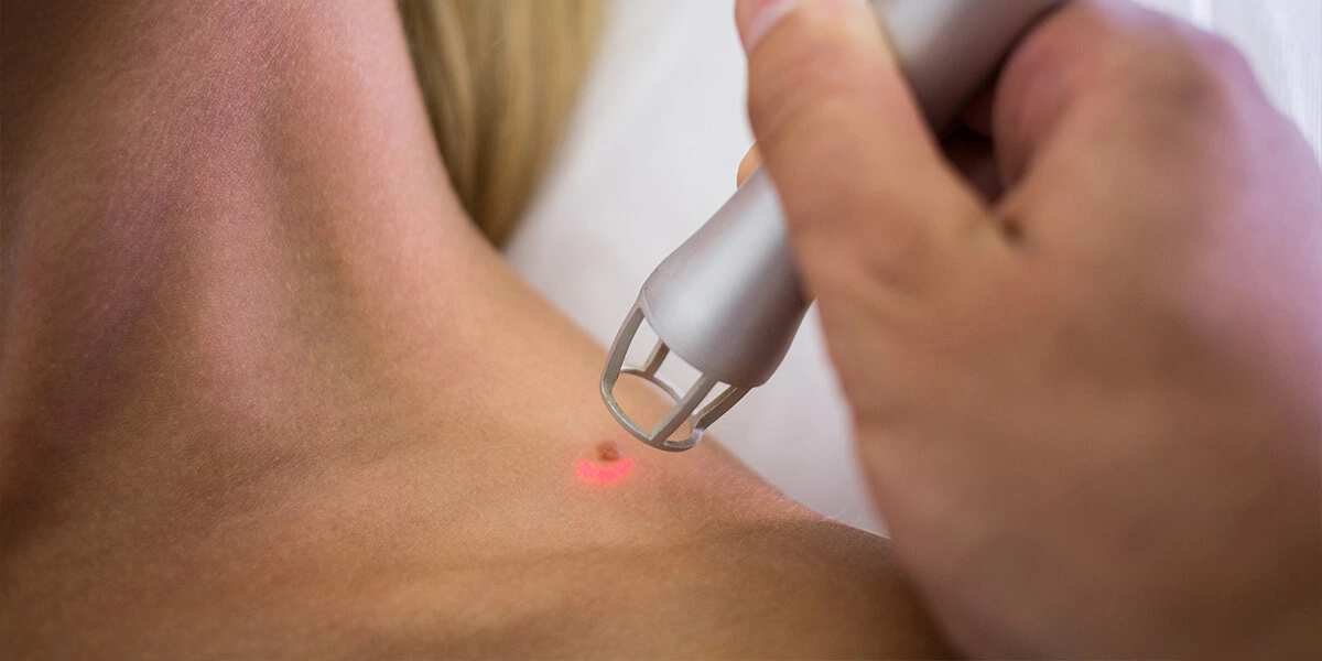 Dermatologie Suceava